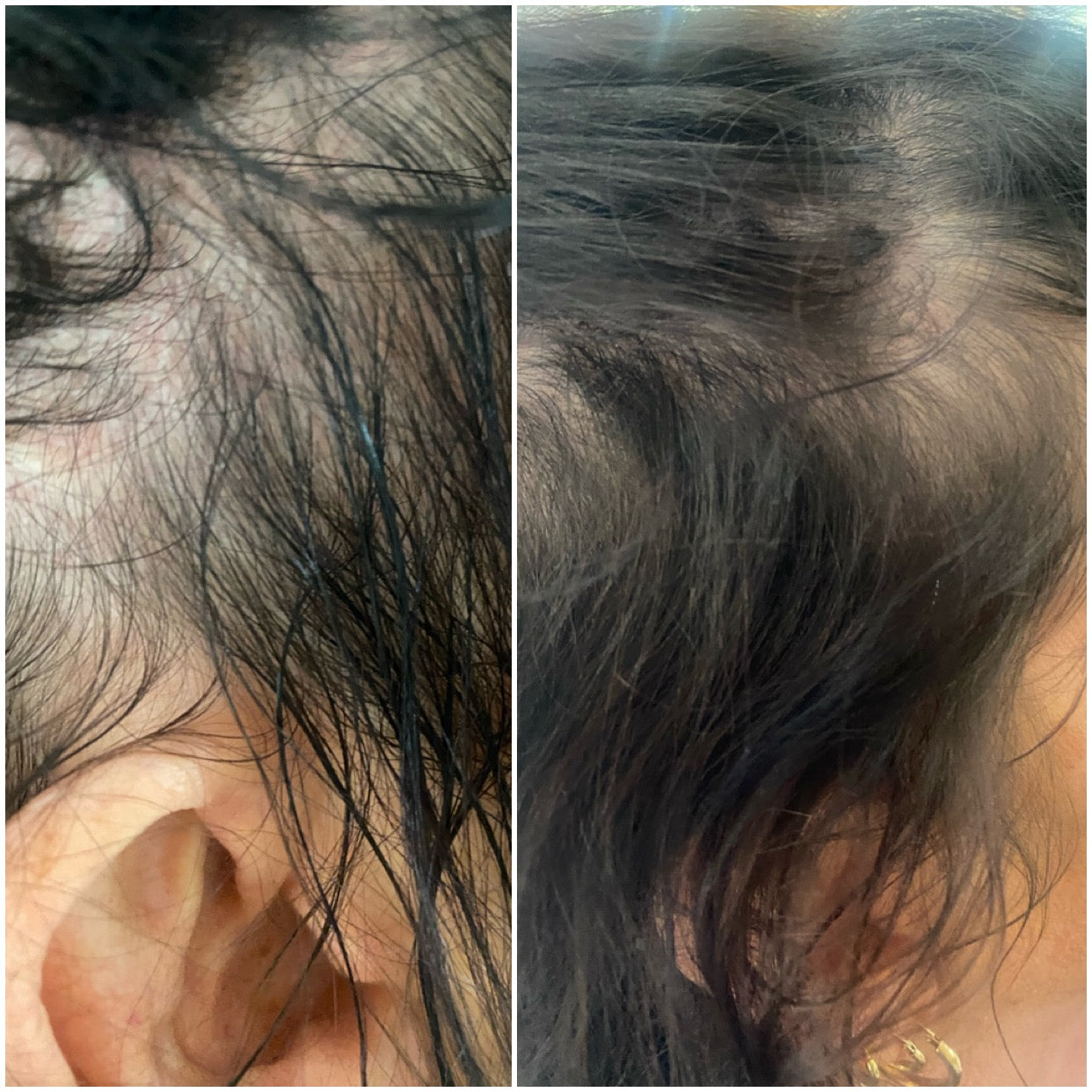 Kooswalla hair loss treatment — professional Haircare that helps stimulate hair growth and reduce hair fall, designed for salons and individuals. Available for wholesale and retail purchase.