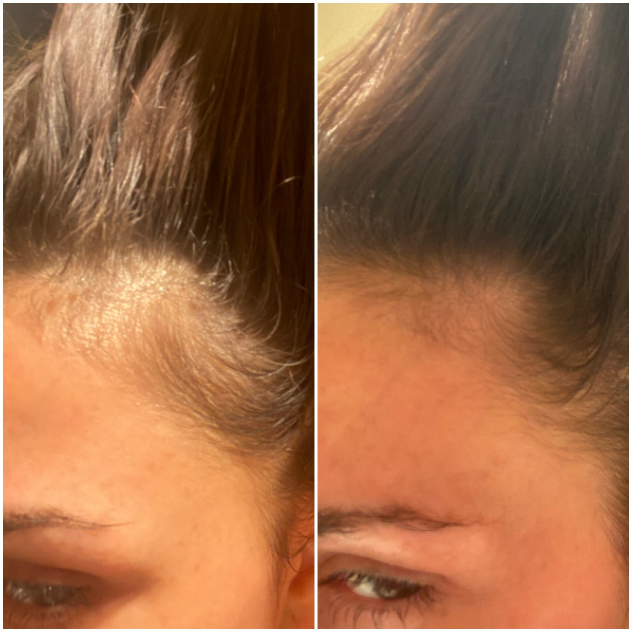 Kooswalla hair loss treatment — professional Haircare that helps stimulate hair growth and reduce hair fall, designed for salons and individuals. Available for wholesale and retail purchase.
