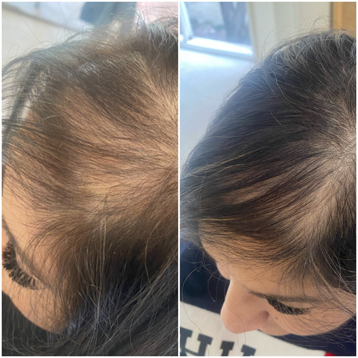 Kooswalla hair loss treatment — professional Haircare that helps stimulate hair growth and reduce hair fall, designed for salons and individuals. Available for wholesale and retail purchase.